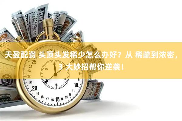 天盈配资 头顶头发稀少怎么办好？从 稀疏到浓密，3 大妙招帮你逆袭！